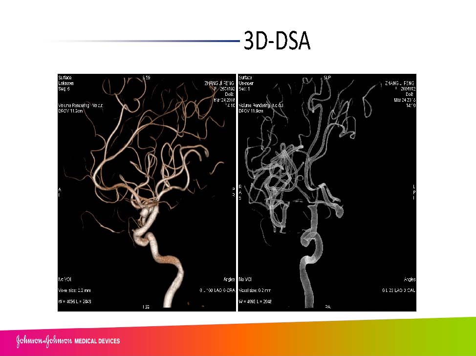 0413 赵兵AcoA 栓塞_页面_09.jpg